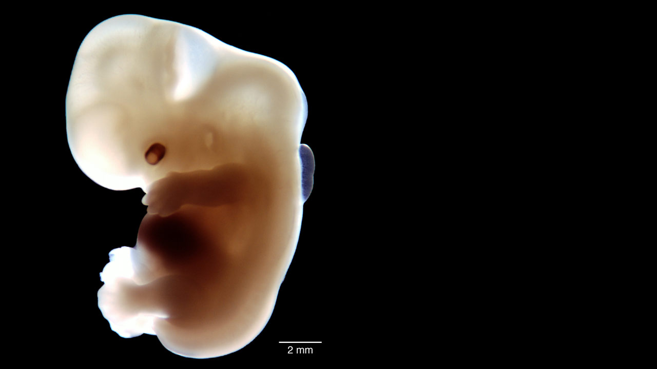 Picture An Embryo - Science Friday