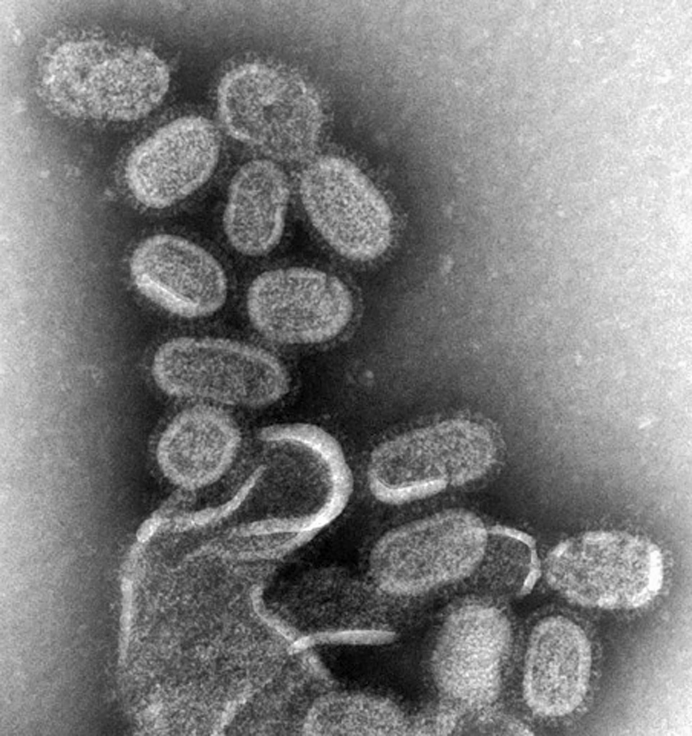 human influenza virus microscope