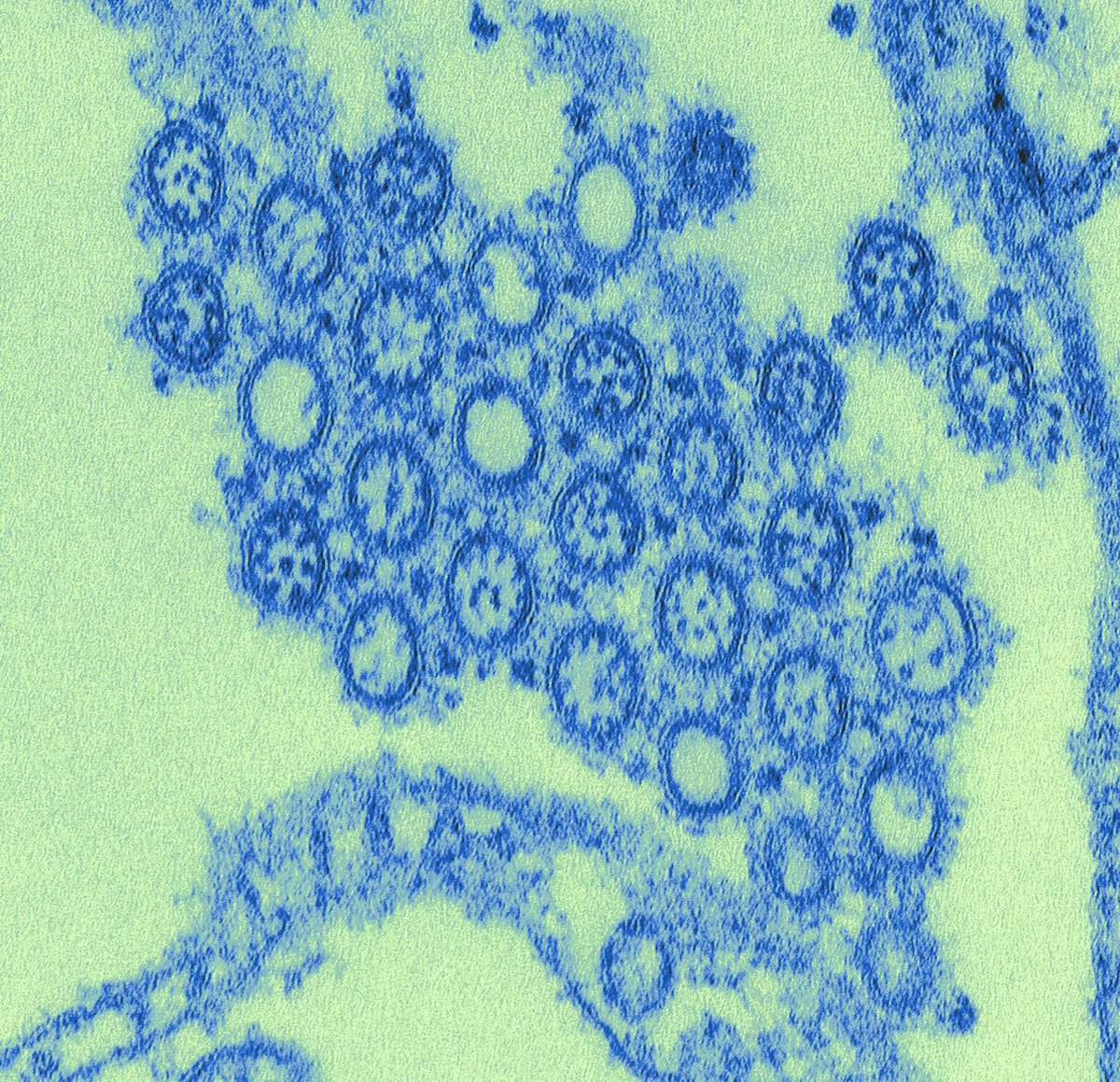 virus electron microscope color