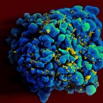 Third Person Cured From HIV, Thanks To Umbilical Cord Stem Cells