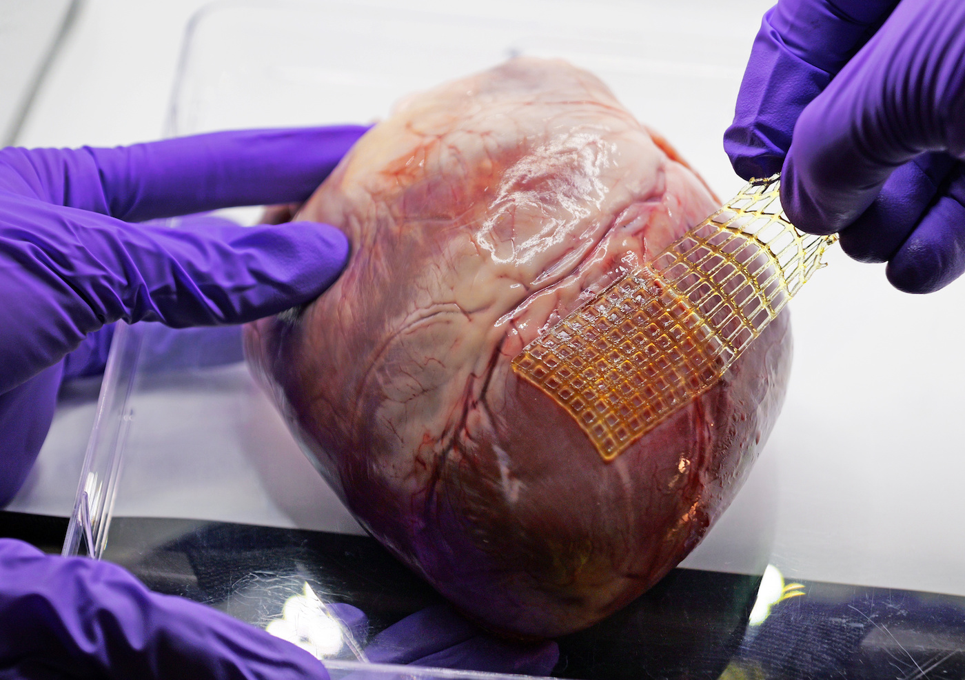 A pic heart with a bandage being stuck on it. The bandage is a flexible rectangular waffle pattern of yellow hydrogel.