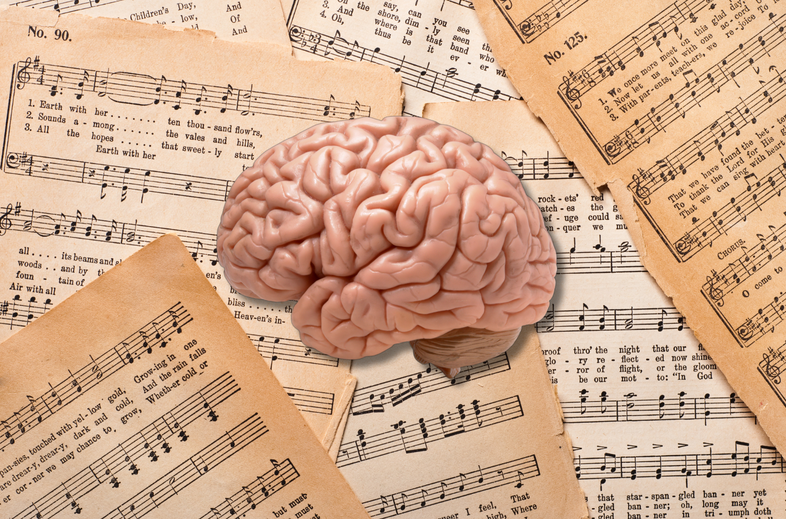 An image of a human brain overlaid over sheet music